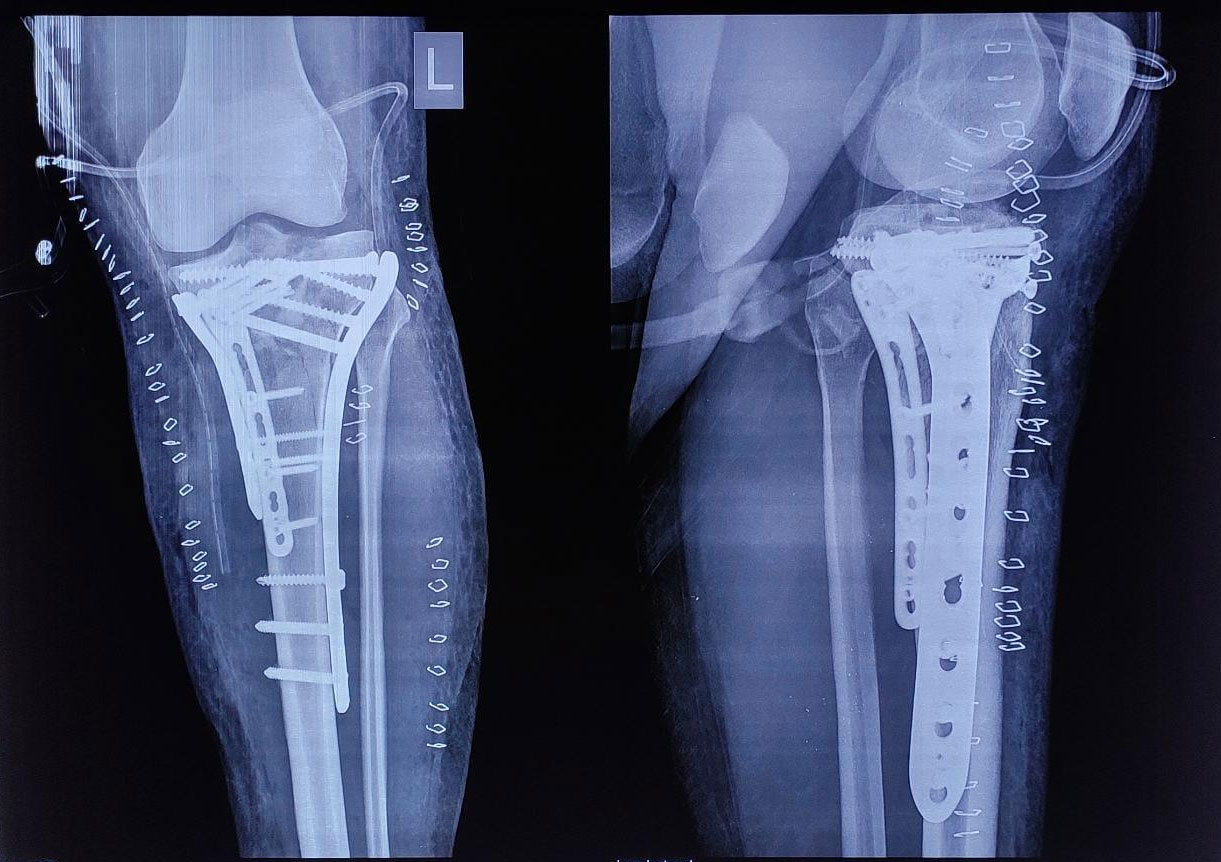 Trauma Surgery